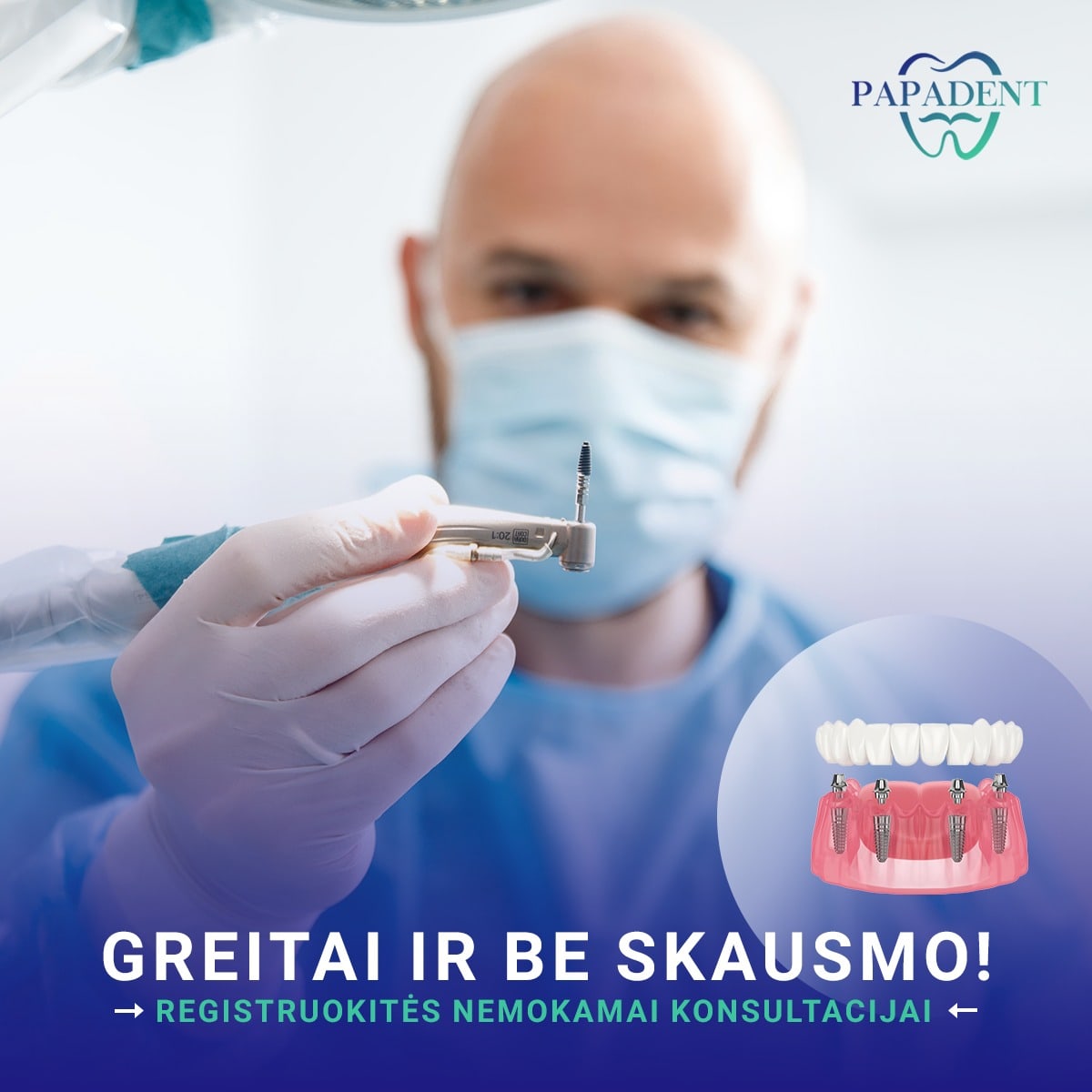Nemokama konsultacija dantų implantacijai