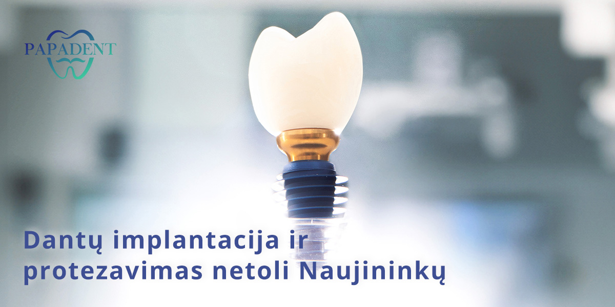 Dantų implantacija Naujininkuose