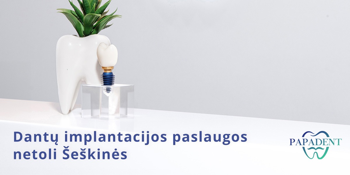 Dantų implantacija Šeškinėje
