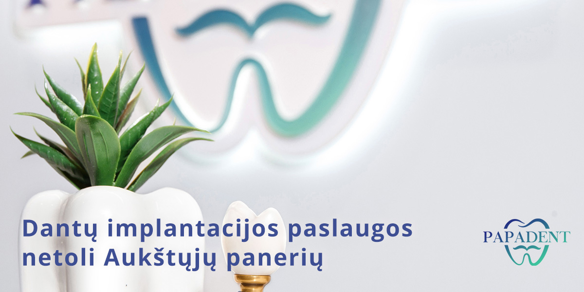 Dantų implantacija Aukštuosiuose paneriuose