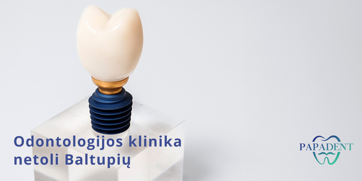Dantų implantacija Baltupiuose