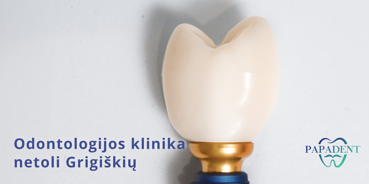 Dantų implantacija Grigiškėse