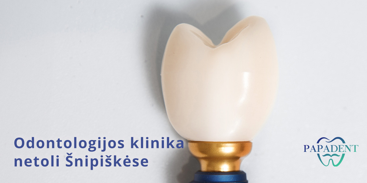 Dantų implantacija Šnipiškėse