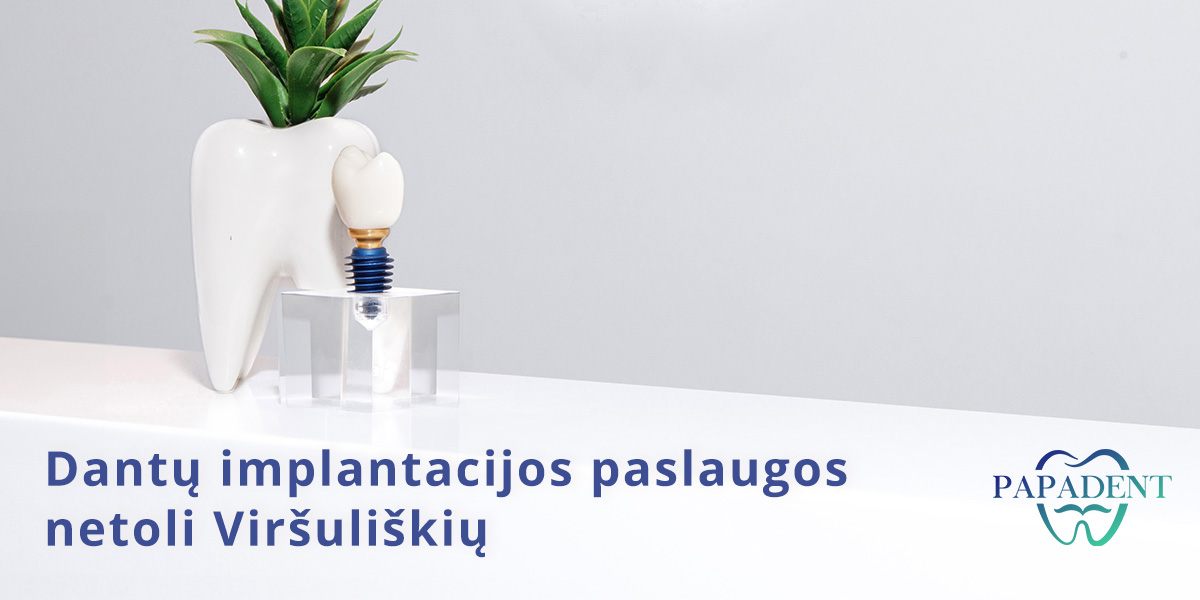 Dantų implantacija Viršuliškėse