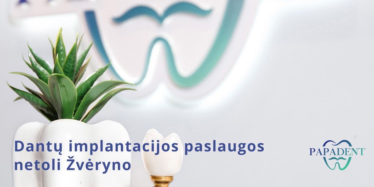 Dantų implantacija Žvėryne