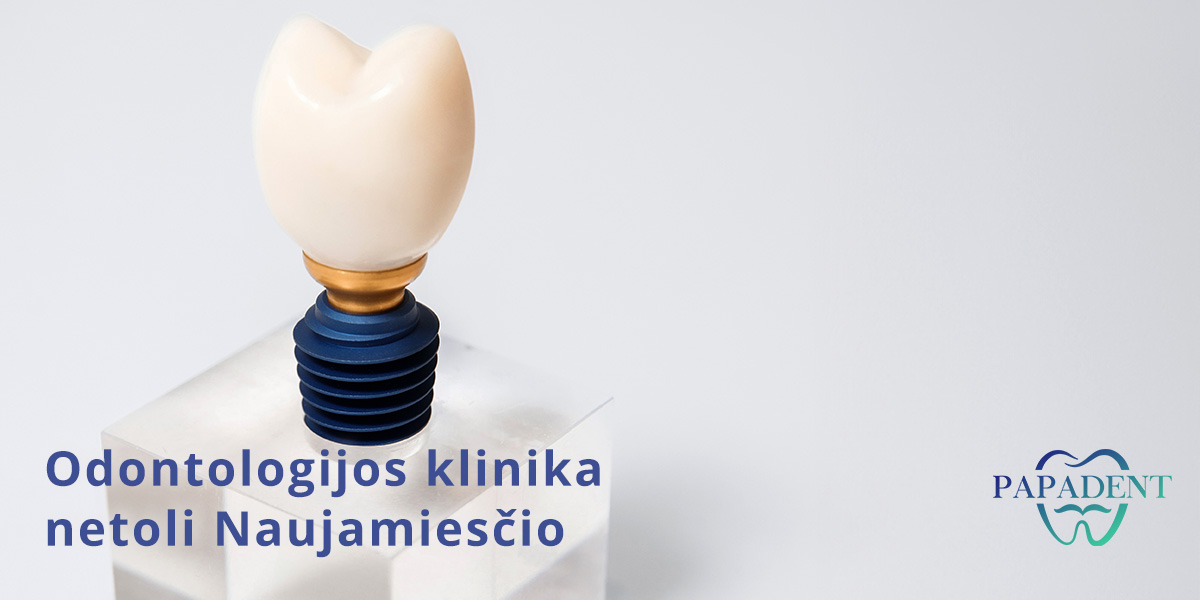 Dantų implantacija Naujamiestyje