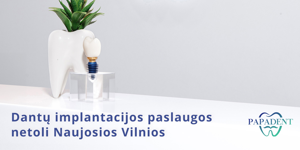 Dantų implantacija Naujoji Vilnia