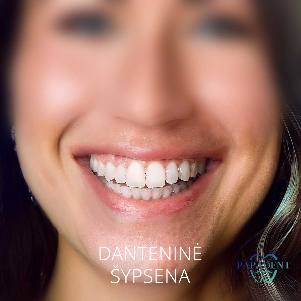 Danteninė šypsena