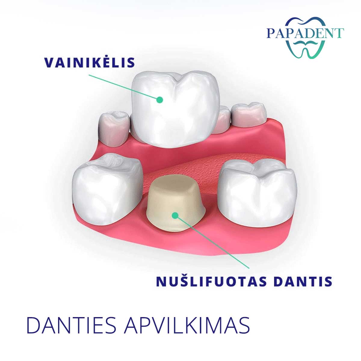 Danties apvilkimas